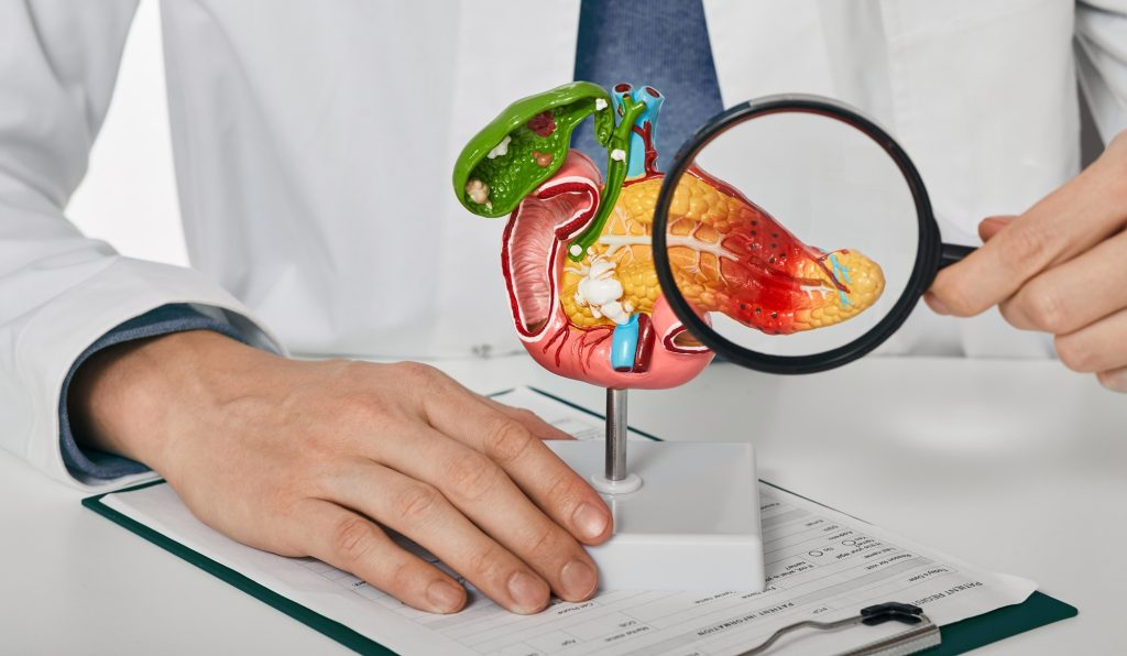 Nowy lek na raka trzustki. Rasonque (daraxonrasib) zatwierdzony przez FDA