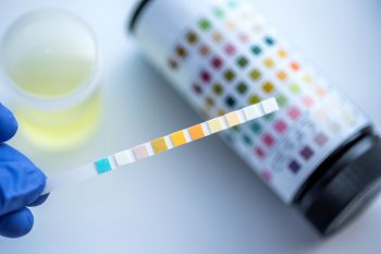 Czym różni się sterylny pojemnik na mocz od niesterylnego?