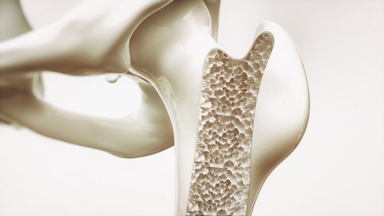 Osteoporoza Osteoporoza – objawy, leczenie, profilaktyka