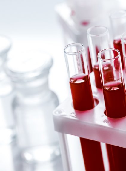 Zespół antyfosfolipidowy – objawy i sposoby leczenia