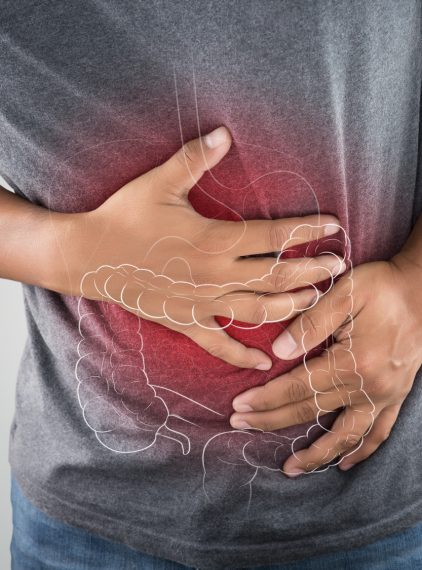 SIBO. Czy bakterii w jelitach może być za dużo?