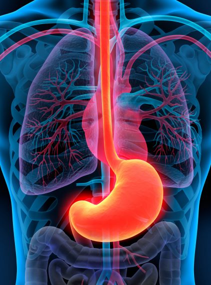 Przewlekłe zapalenie błony śluzowej żołądka – przyczyny, objawy, leczenie