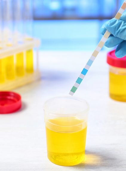 Zakwaszenie organizmu – objawy, przyczyny i profilaktyka