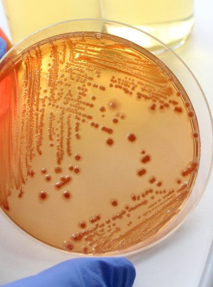 Oporność na antybiotyki – problem wśród ludzi czy zagrożenie w hodowlach zwierzęcych?