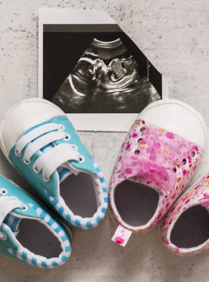 Bliźnięta o różnych kolorach skóry – czy to możliwe?