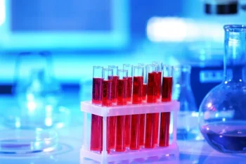 Ferrytyna. Badania i normy