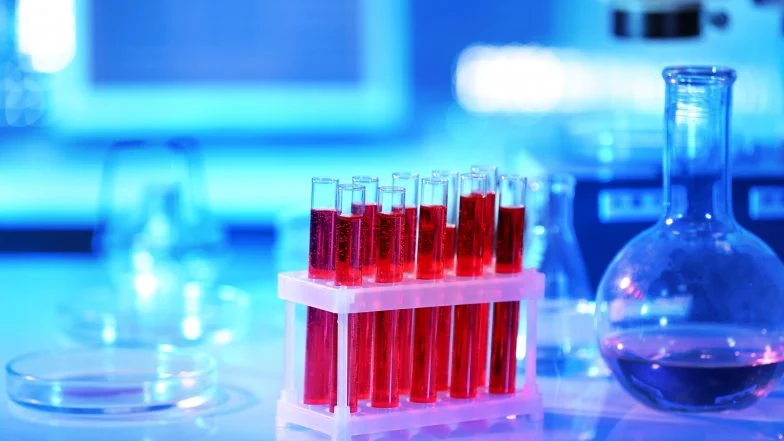 Ferrytyna. Badania i normy