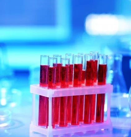 Ferrytyna. Badania i normy