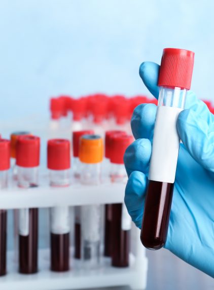 Onkopierwiastki. Czym są i czy onkopakiet wykryje raka?