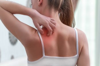 Jak leczyć łupież różowy Giberta?