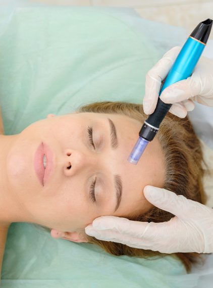 Mezoterapia igłowa. Kiedy warto ją zastosować?