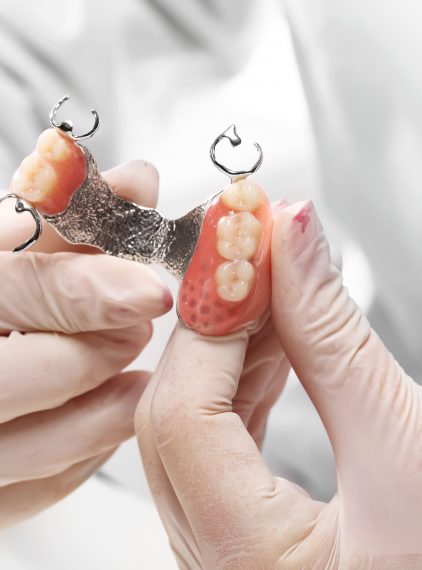 Jakie są rodzaje protez zębowych?