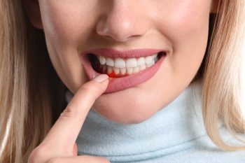 Periodontologia – co to jest?