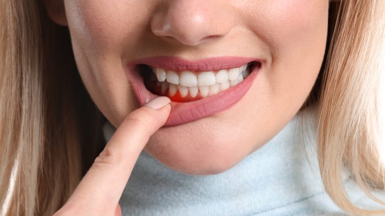 Periodontologia – co to jest?