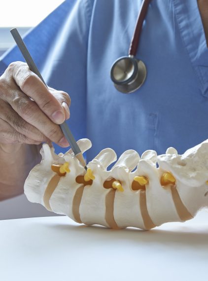 Przepuklina krążka międzykręgowego – jak przebiega leczenie?