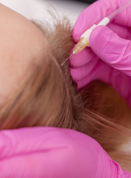 Karboksyterapia – jakie są wskazania do jej wykonania?