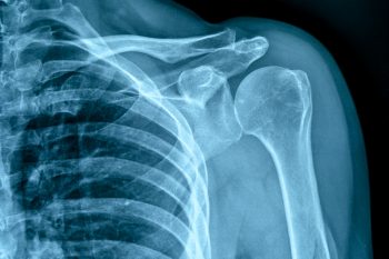 Czy w ciąży można wykonywać RTG?