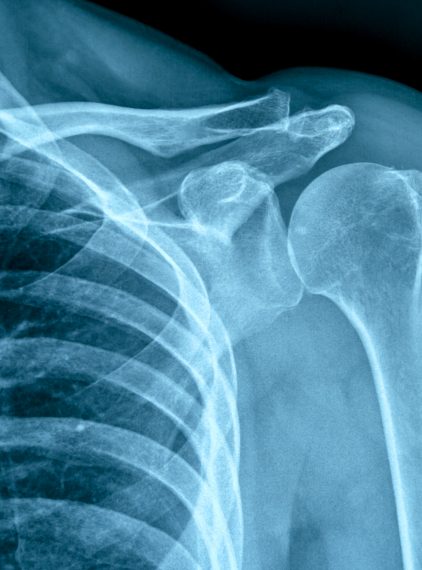 Czy w ciąży można wykonywać RTG?