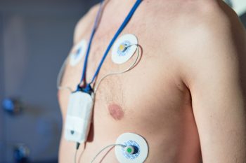 Holter EKG – na czym polega to badanie?