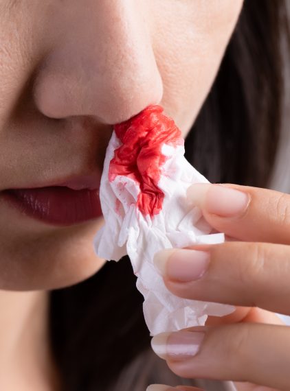 Przedłużające się krwawienia? To może być choroba von Willebranda