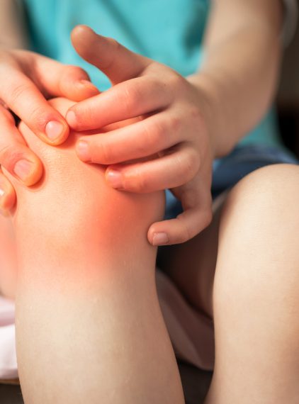 Co to jest rumień guzowaty?