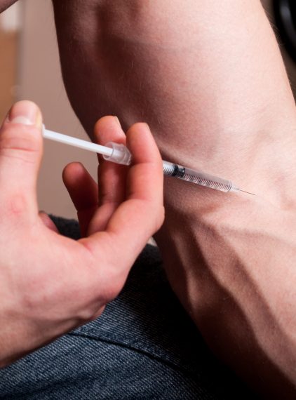 Czym są sterydy anaboliczne?