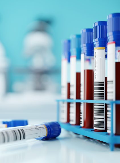 Czym jest jonogram i kiedy się go wykonuje?