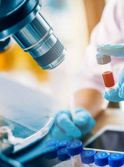 Jakie badania warto wykonać po COVID-19?