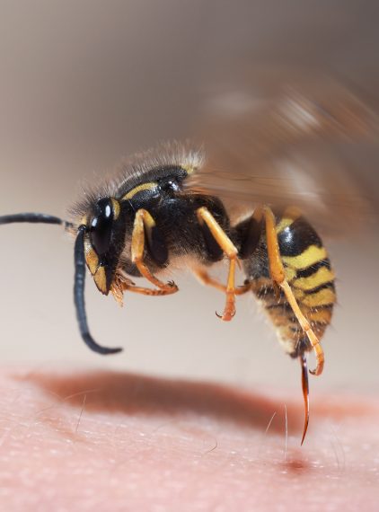 Alergia na jad owadów – czym się charakteryzuje?
