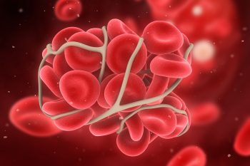 Leki przeciwzakrzepowe – które z nich stosuje się najczęściej?