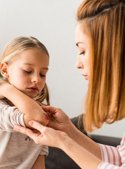 Opatrunki hydrożelowe – kiedy je stosować?