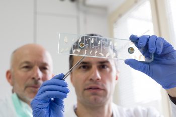 Włośnica – charakterystyka choroby, objawy, diagnostyka i leczenie