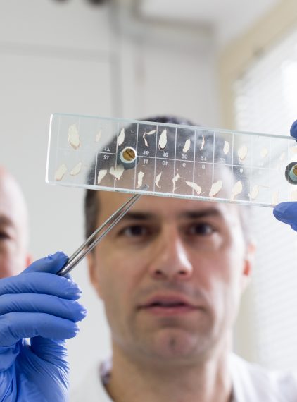 Włośnica – charakterystyka choroby, objawy, diagnostyka i leczenie