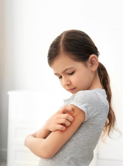 Alergia kontaktowa na metale u dzieci – jak ją leczyć?