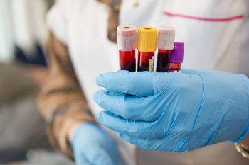 Jakie podstawowe badania krwi wykonuje się na czczo?