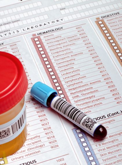 Jak pobrać próbkę moczu do badania laboratoryjnego?