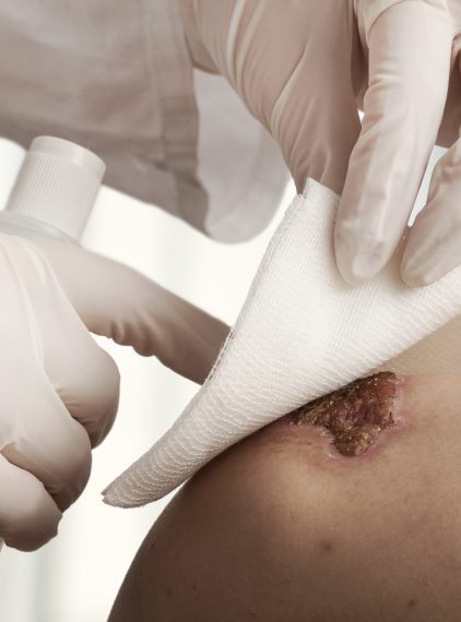 Gaza – czym jest, rodzaje i wady