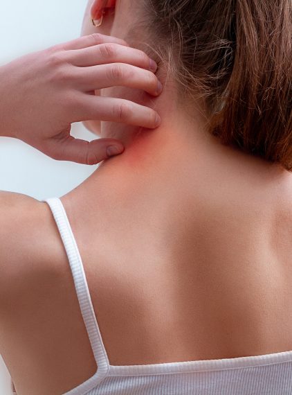 Alergia skórna. Przyczyny, objawy i leczenie. Jak złagodzić uczulenie na skórze?