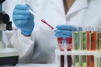 Badania na pasożyty. Jakie wykonać?