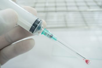 Biopsja cienkoigłowa – jak się przygotować i ile czeka się na wynik?