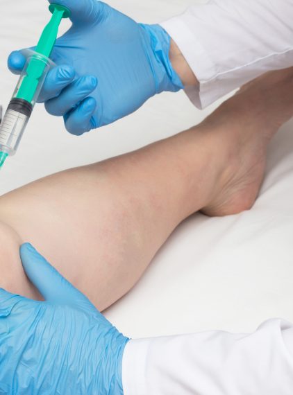 Badanie płynu stawowego – na czym polega?