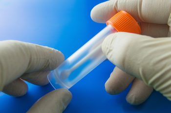 Jak pobrać kał do badania? Badanie kału a sposób pobrania próbki