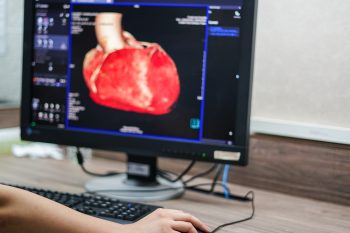 Koronarografia. Co to jest? Przygotowanie i wskazania do badania