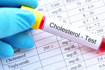 Wysoki cholesterol. Jakie są przyczyny i objawy? Jak go obniżyć?