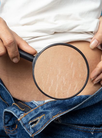 Zabiegi beauty dla kobiet karmiących piersią