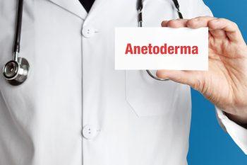Zanik plamisty skóry (anetoderma) – objawy, przyczyny i leczenie