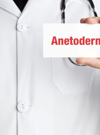 Zanik plamisty skóry (anetoderma) – objawy, przyczyny i leczenie