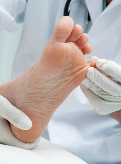 Łupież rumieniowy (erythrasma) – co to jest? Objawy, przyczyny i leczenie