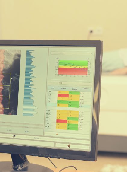 Badanie densytometryczne – do czego służy?