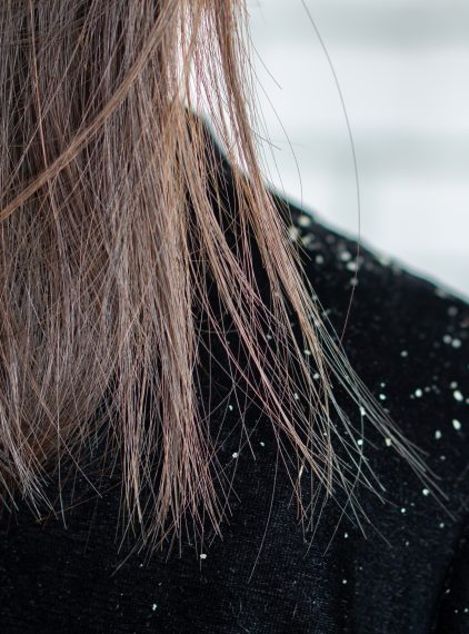 Domowe sposoby na łupież